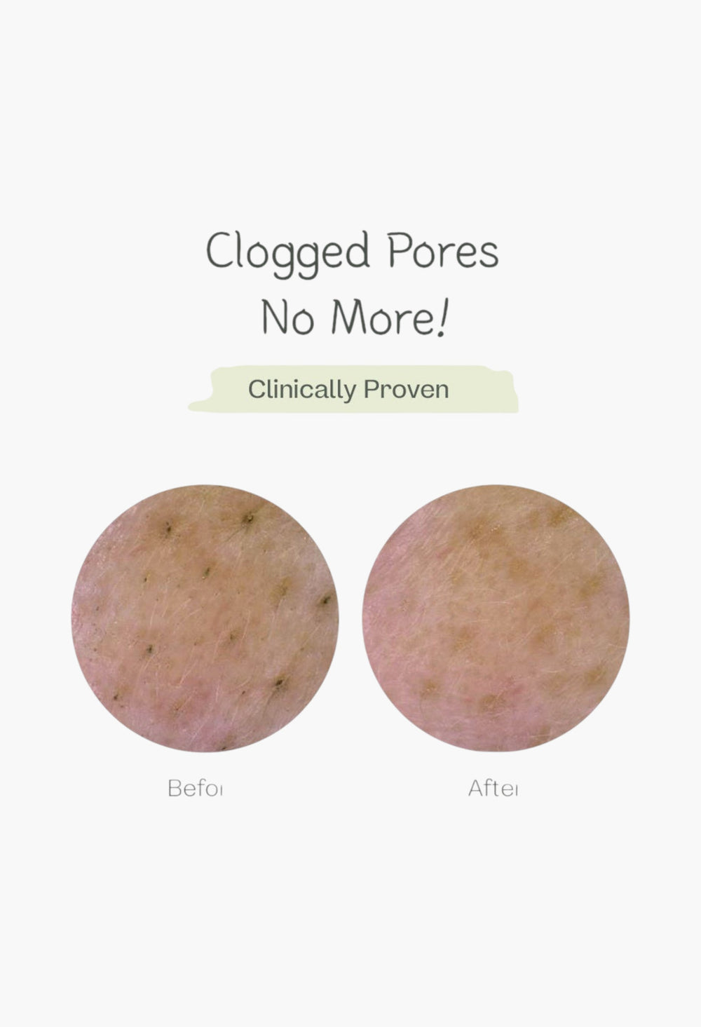 Deep Pore Cleansing Soda Foam - GLAM MODA