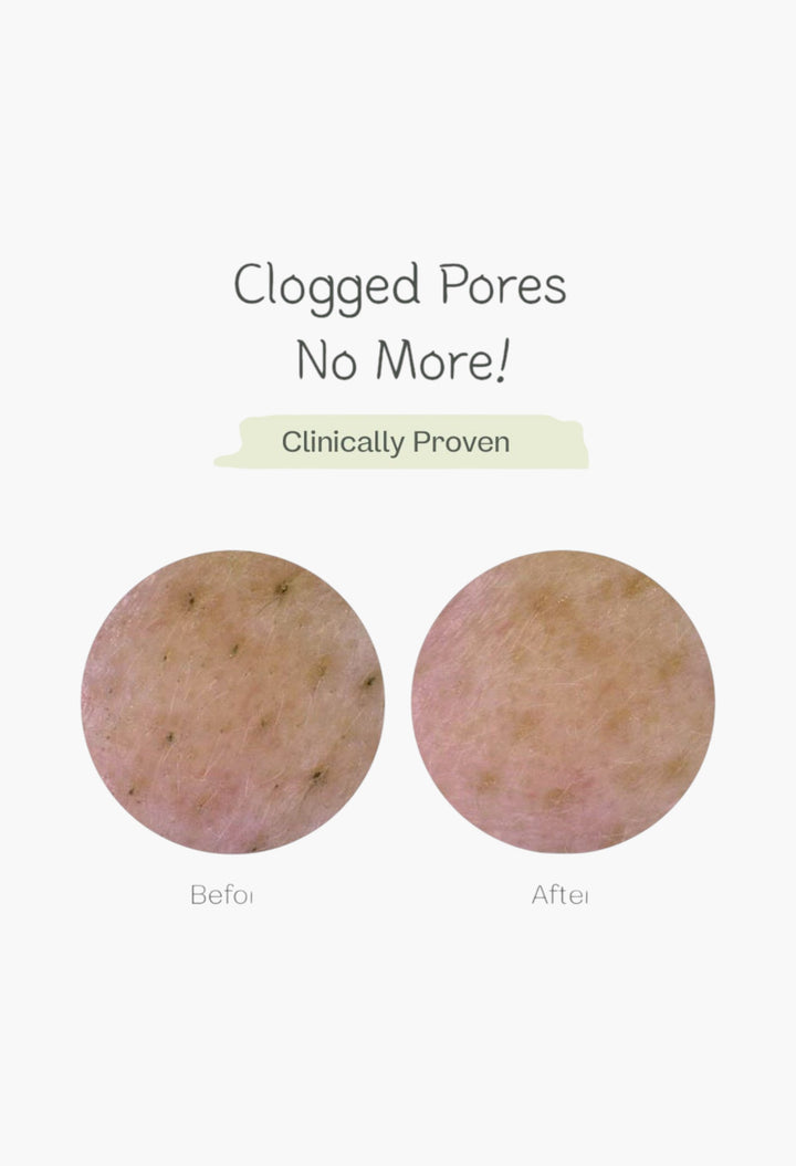 Deep Pore Cleansing Soda Foam - GLAM MODA