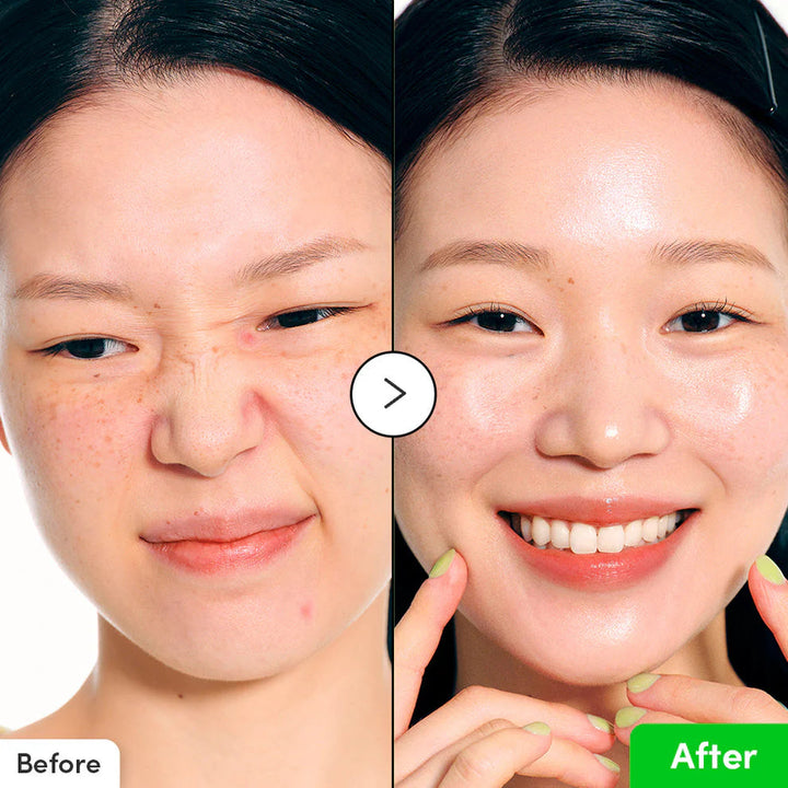 Aloe PDRN Calming Serum - GLAM MODA