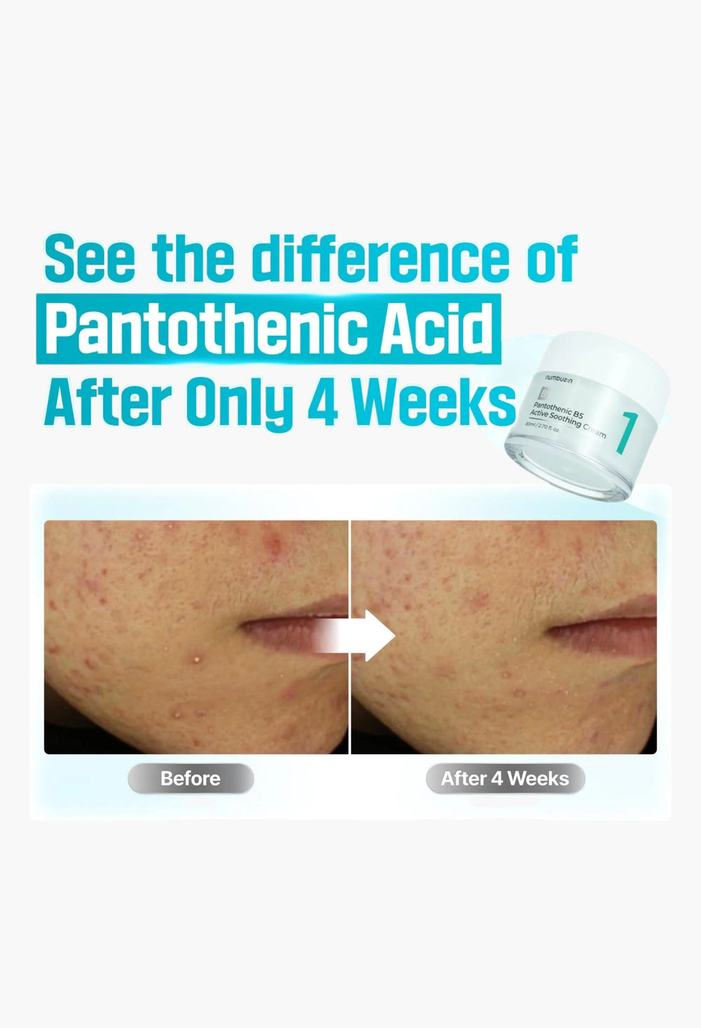 No.1 Pantothenic B5 Active Soothing Cream - GLAM MODA