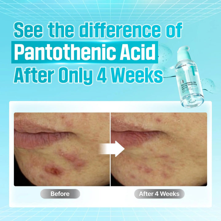 No.1 Pantothenic B5 Active Soothing Serum - GLAM MODA