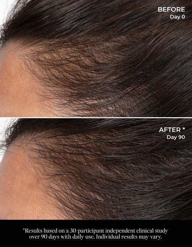 Let There Be Hair Scalp Serum - GLAM MODA