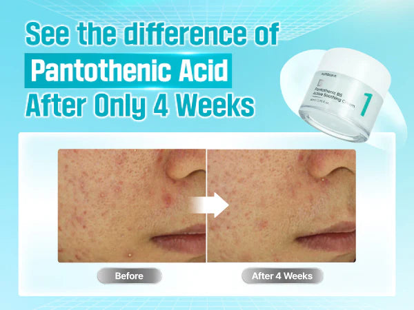 No.1 Pantothenic B5 Active Soothing Cream - GLAM MODA
