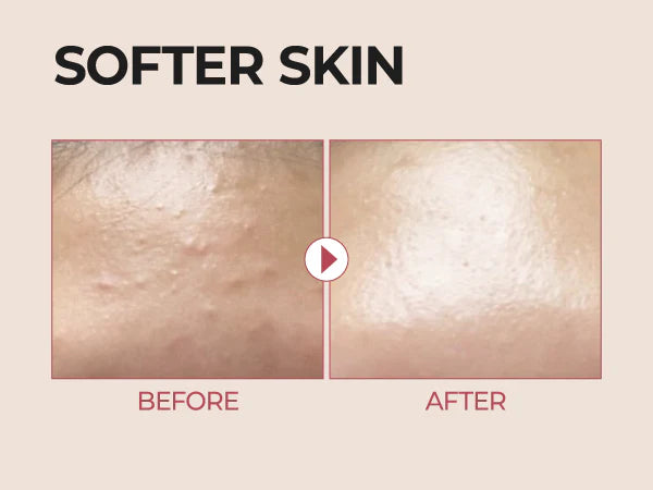 No.3 Skin Softening Serum - GLAM MODA