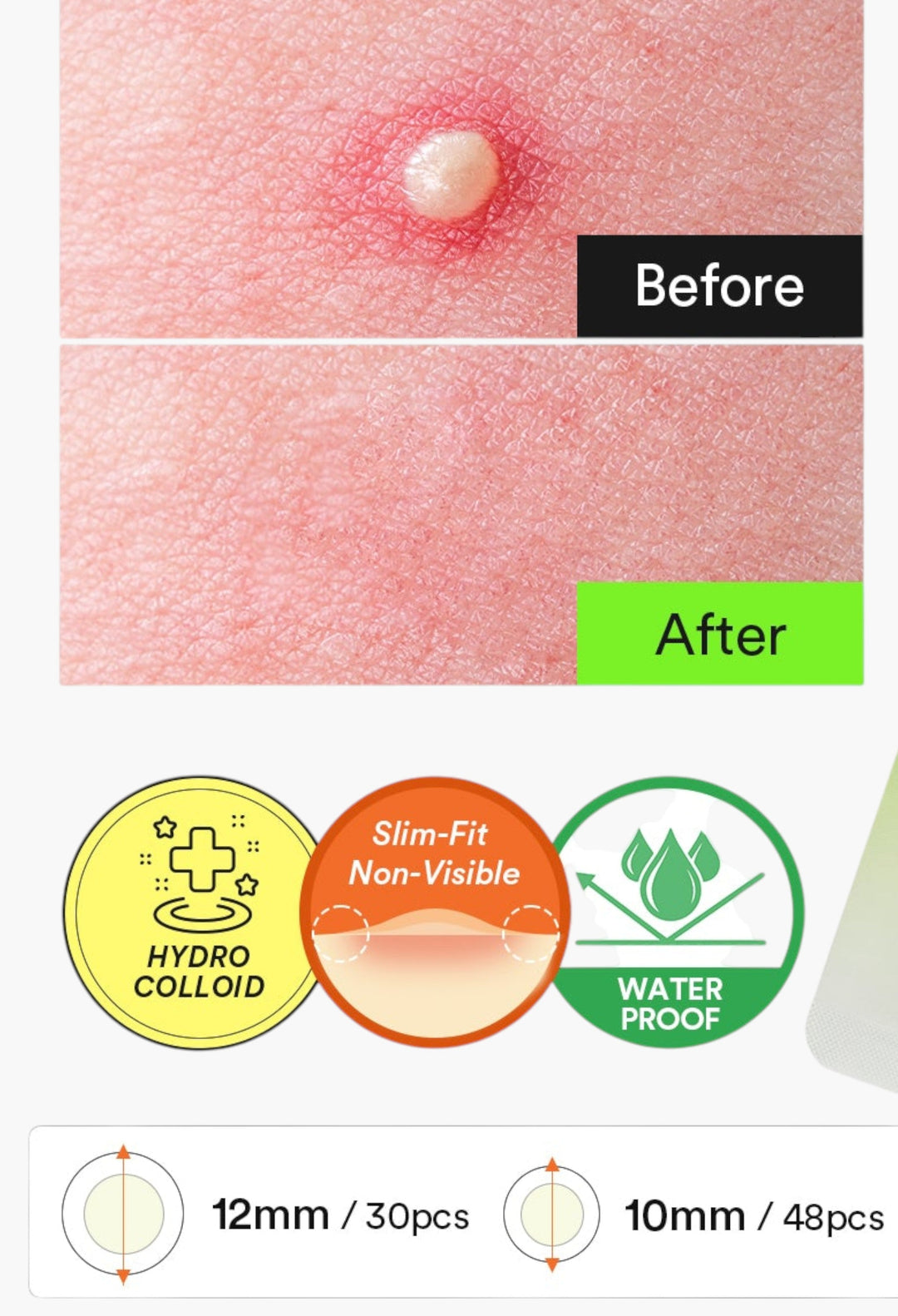 Heartleaf Calming Spot Patch