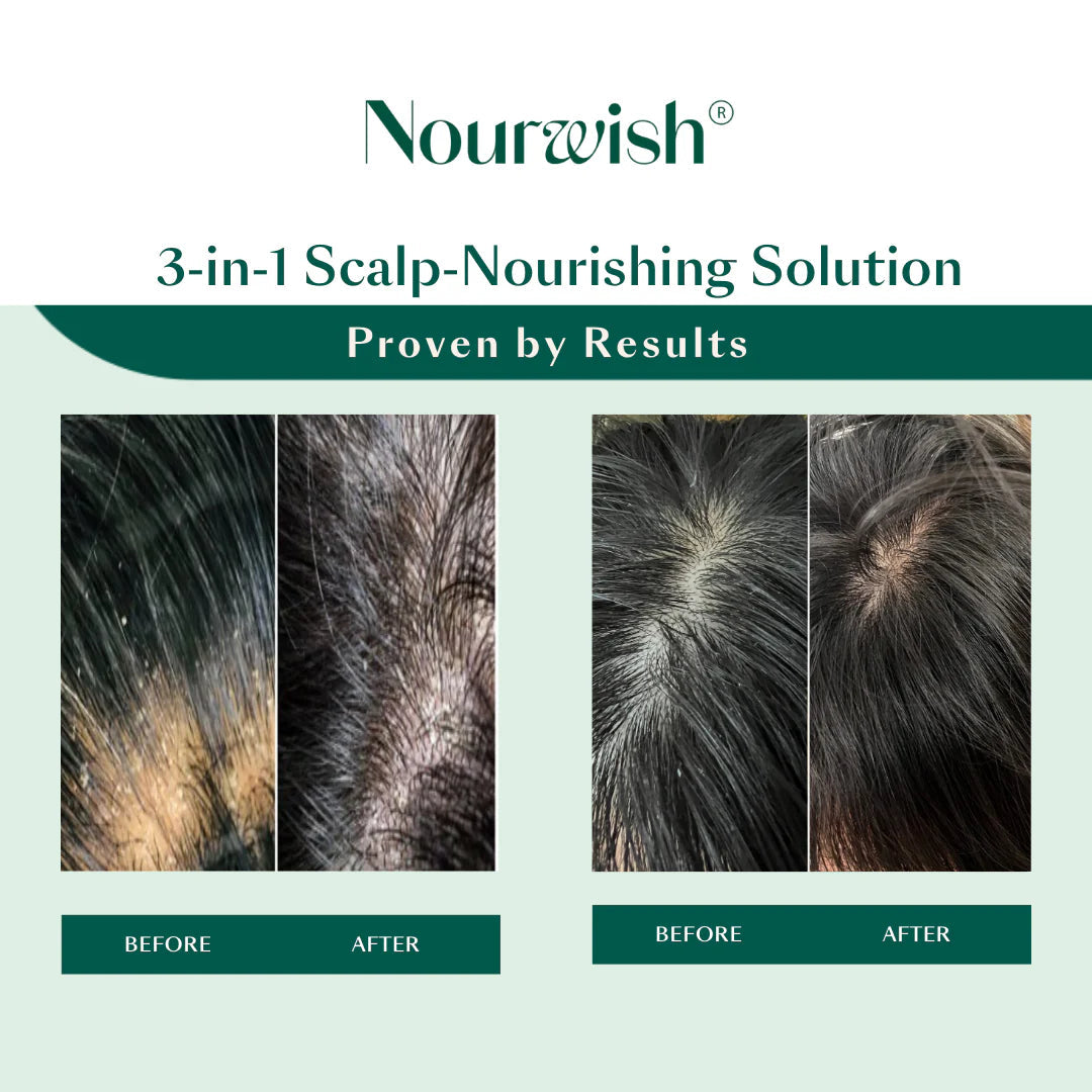 Nourwish Scalp Retreat Nourishing Scalp Serum - GLAM MODA
