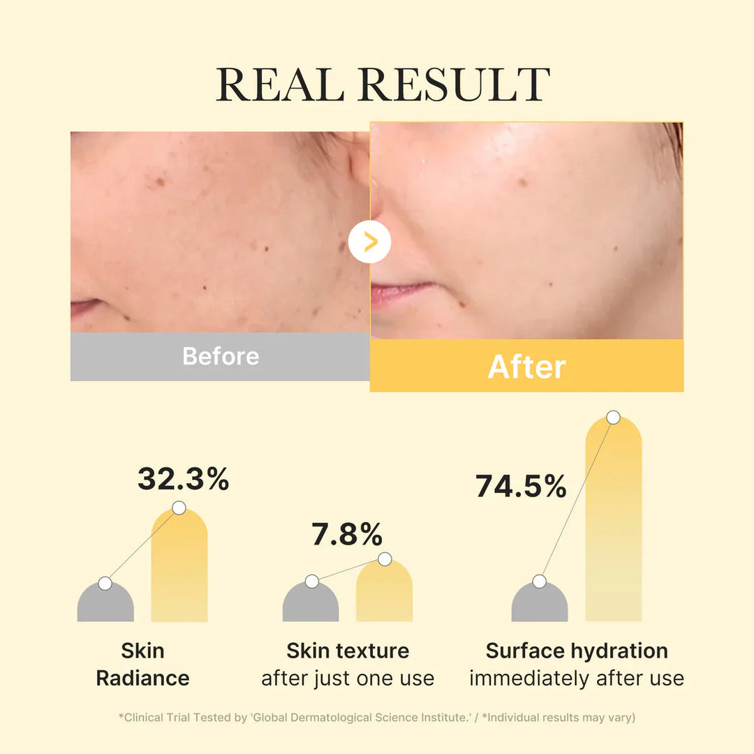 Kojic Acid Turmeric Gold Jelly Mask - GLAM MODA