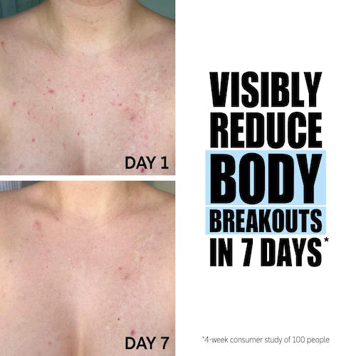 Glycolic Acid Exfoliating Body Stick - GLAM MODA