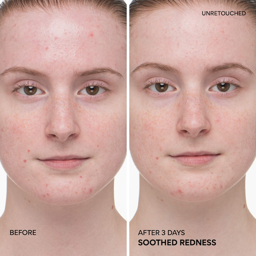 Green Tea Ceramide Milk Toner for Hydration & Barrier Repair - GLAM MODA
