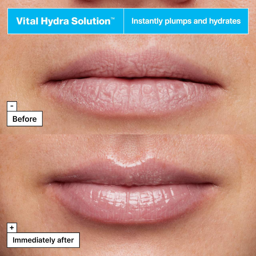 Vital Hydra Solution™ Jelly Bear Lip Mask with Hyaluronic Acid - GLAM MODA