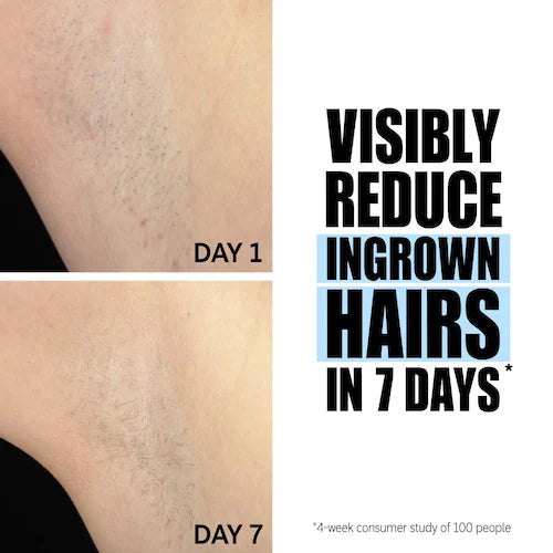 Glycolic Acid Exfoliating Body Stick - GLAM MODA