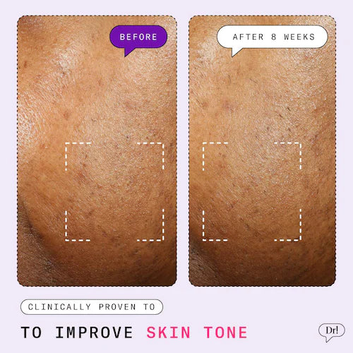 Major Fade Active Seal Dark Spot Vitamin C and Peptide Gel Moisturizer - GLAM MODA
