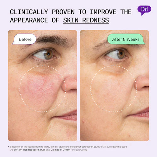 Left Un-Red CalmBack Rich Face Moisturizer for Redness and Skin Barrier Health - GLAM MODA