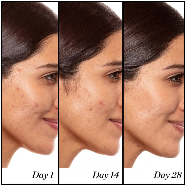 A+ High-Dose Retinoid Serum - GLAM MODA