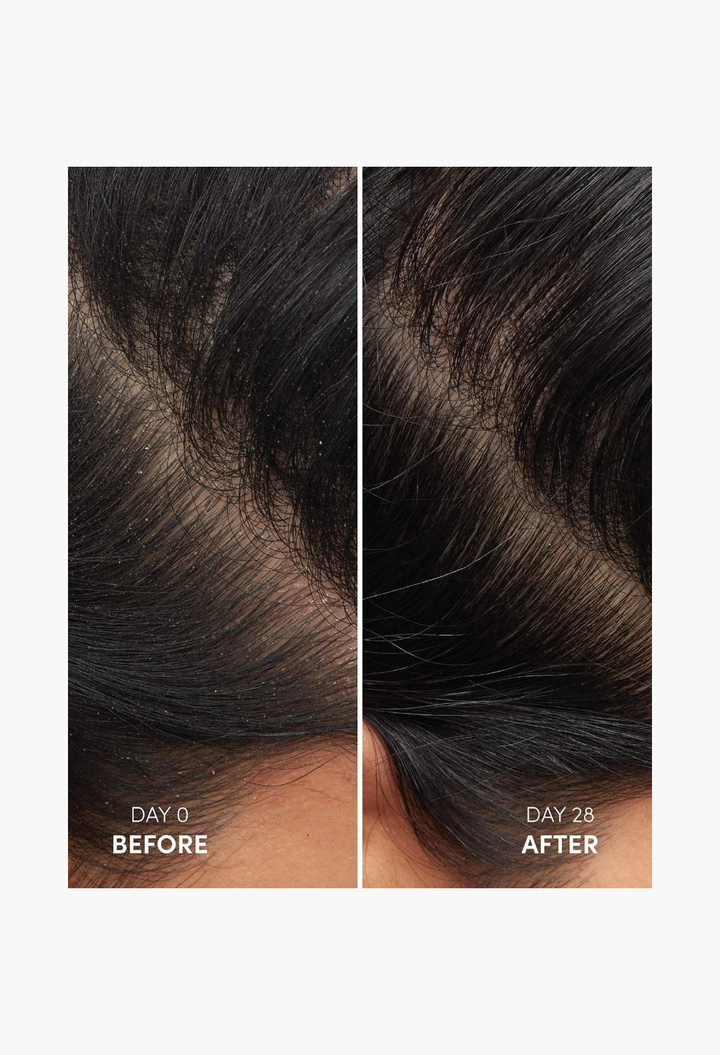 Ouai Anti-Dandruff Hair Shampoo
