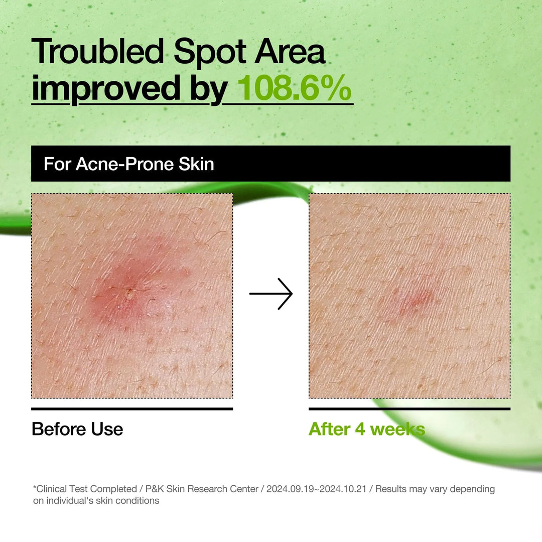 Azelaic Acid 10 Hyaluron Redness Soothing Serum - GLAM MODA