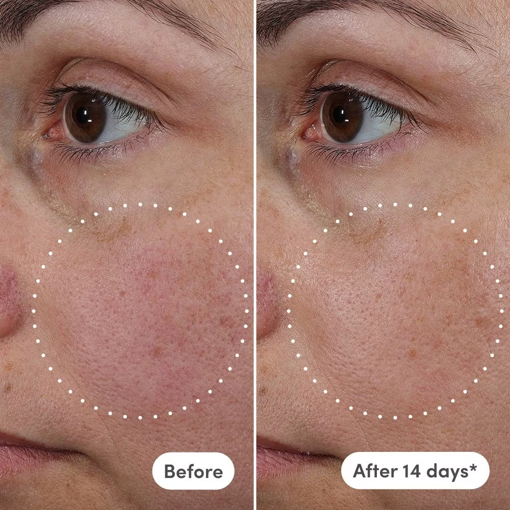 Azelaic Exosome + Vitamin C Serum - Naked Ambition - GLAM MODA