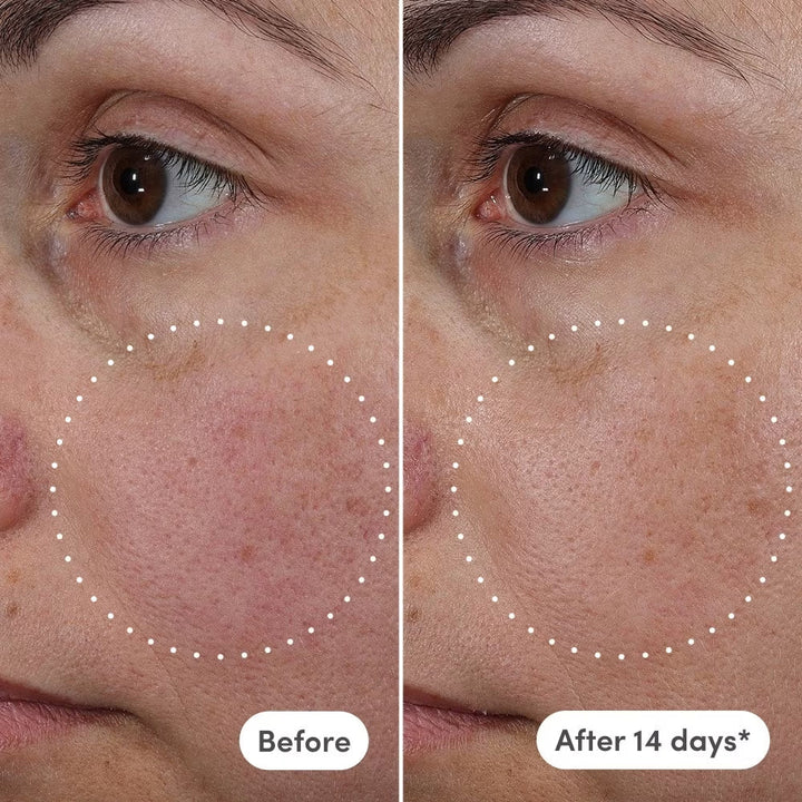 Azelaic Exosome + Vitamin C Serum - Naked Ambition - GLAM MODA