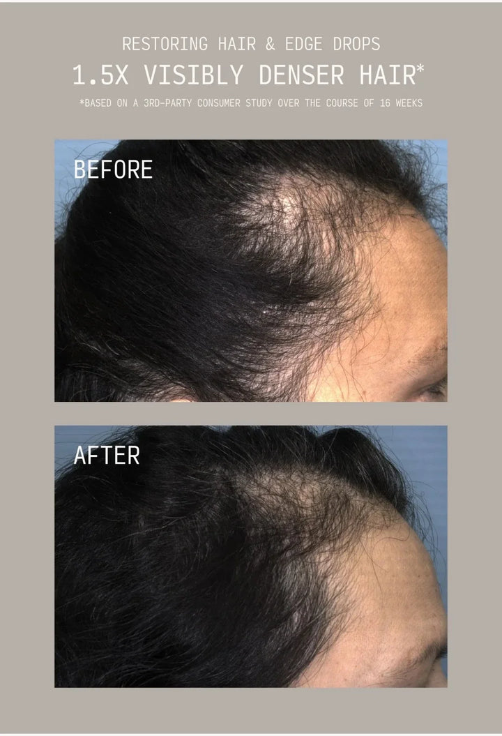 Restoring Hair & Edge Drops