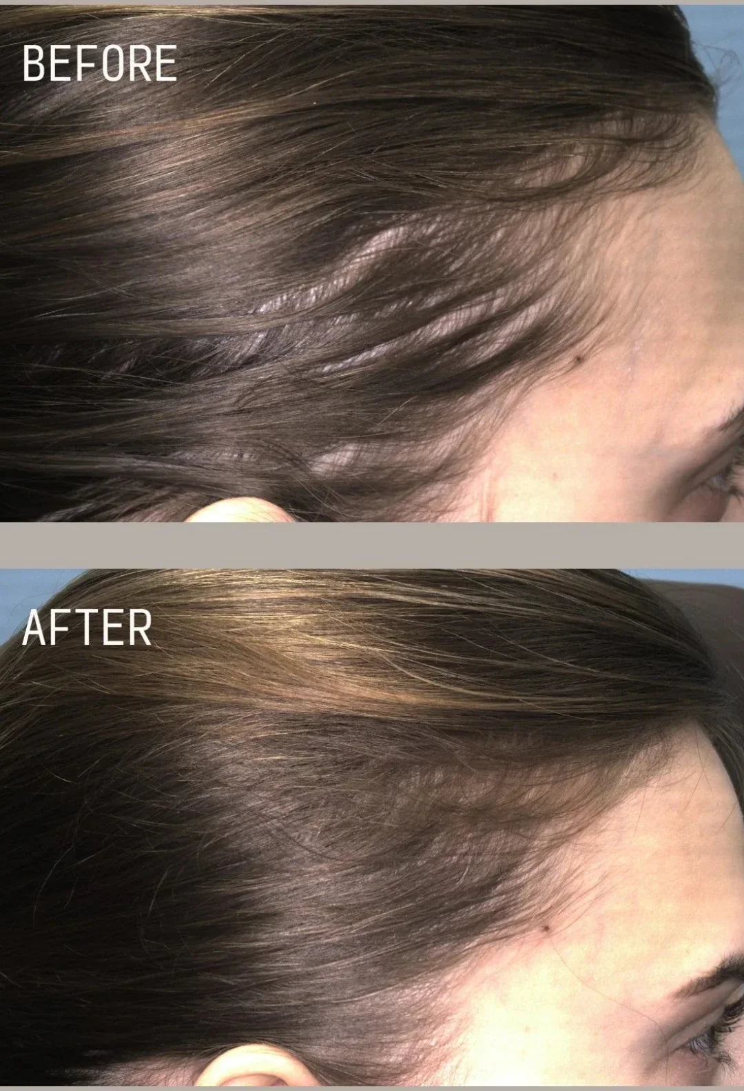 Restoring Hair & Edge Drops