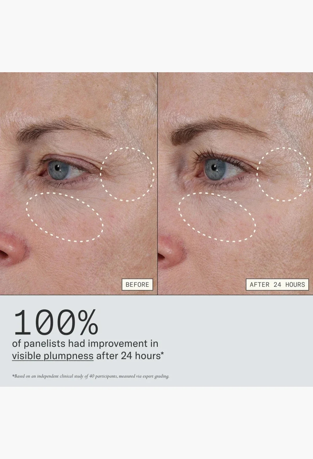 Instant Angel Lipid-Rich Firming Moisturizer