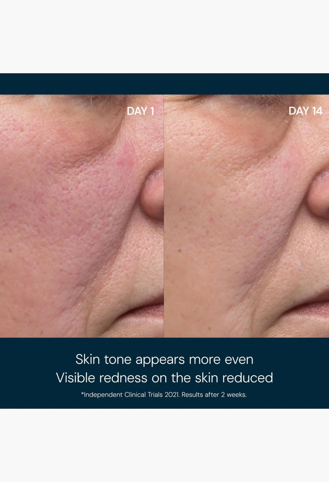 Elemis Dynamic Resurfacing Facial Pads