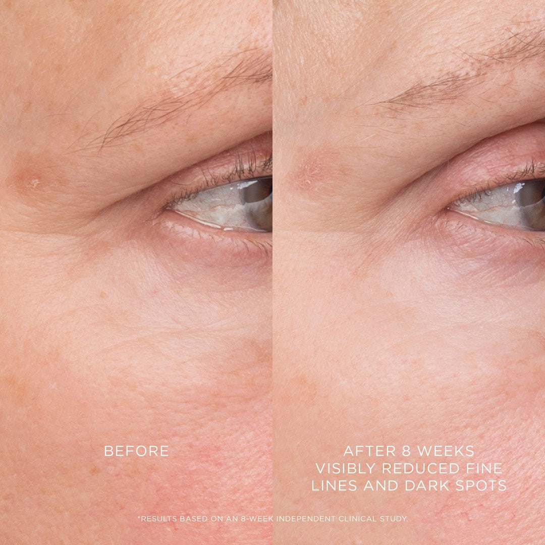 Equilibrium Resurfacing Retinoid Treatment - GLAM MODA