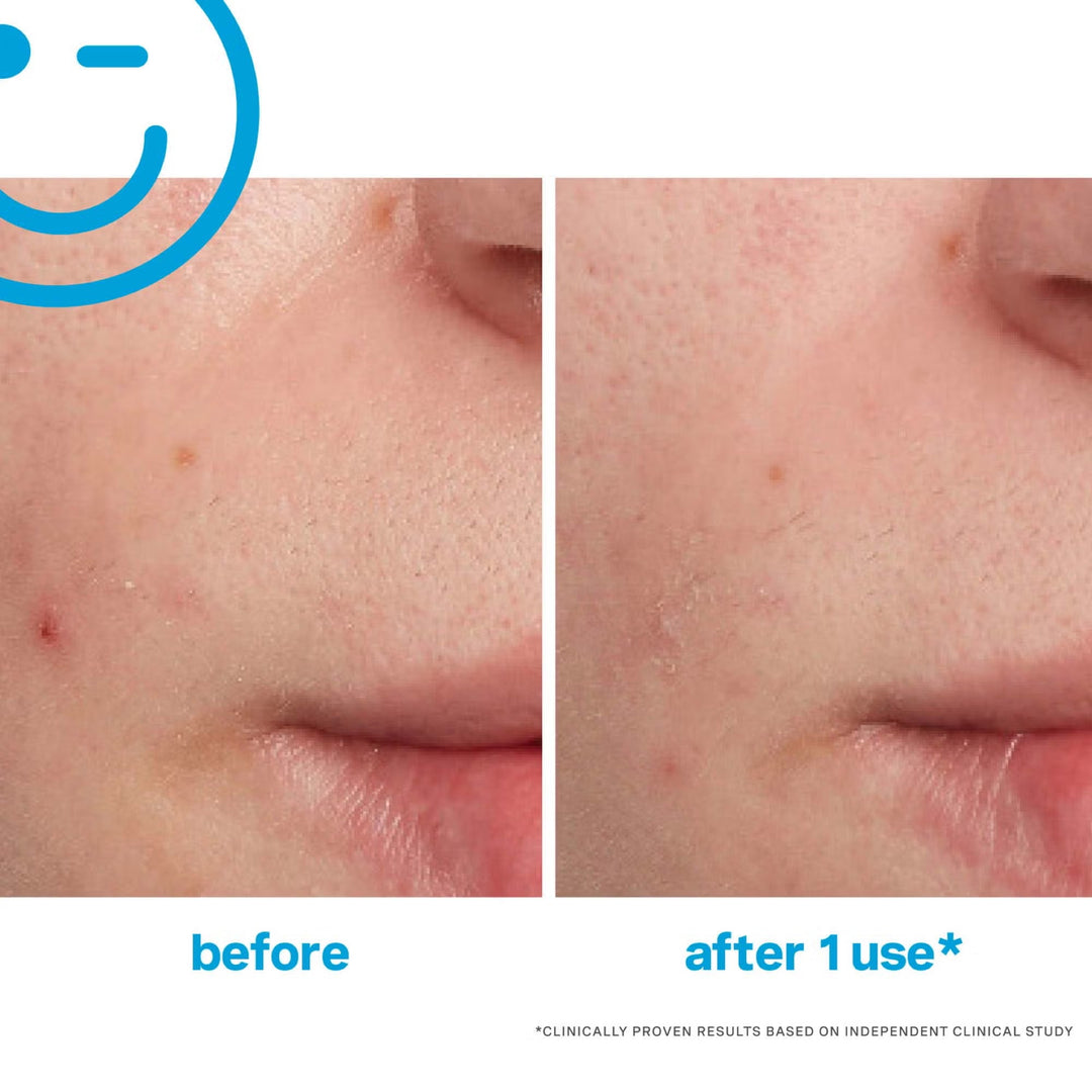 EradiKate Blemish Treatment 30ml - GLAM MODA