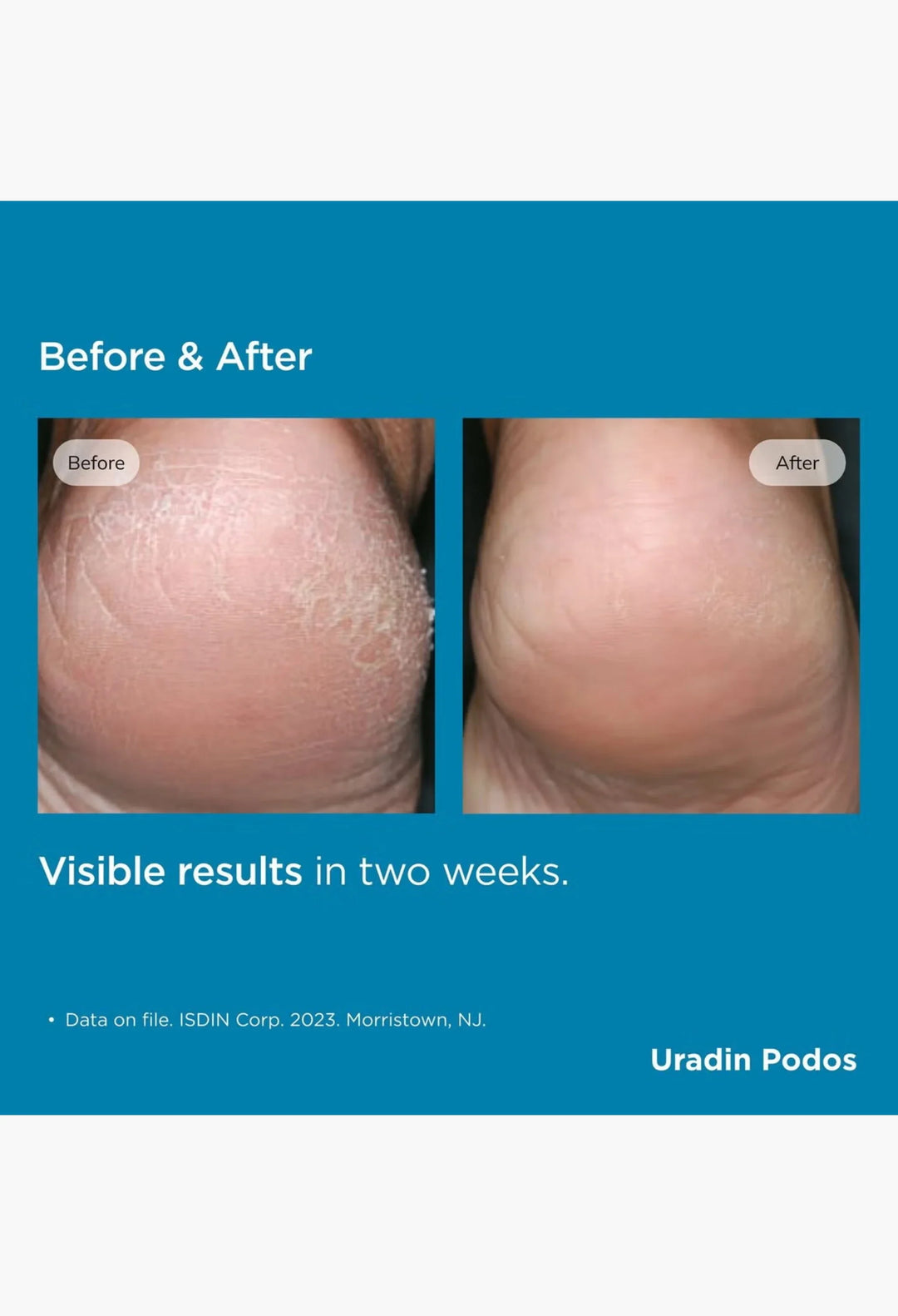 ISDIN Foot Care Uradin® Podos Hydrating Gel Oil