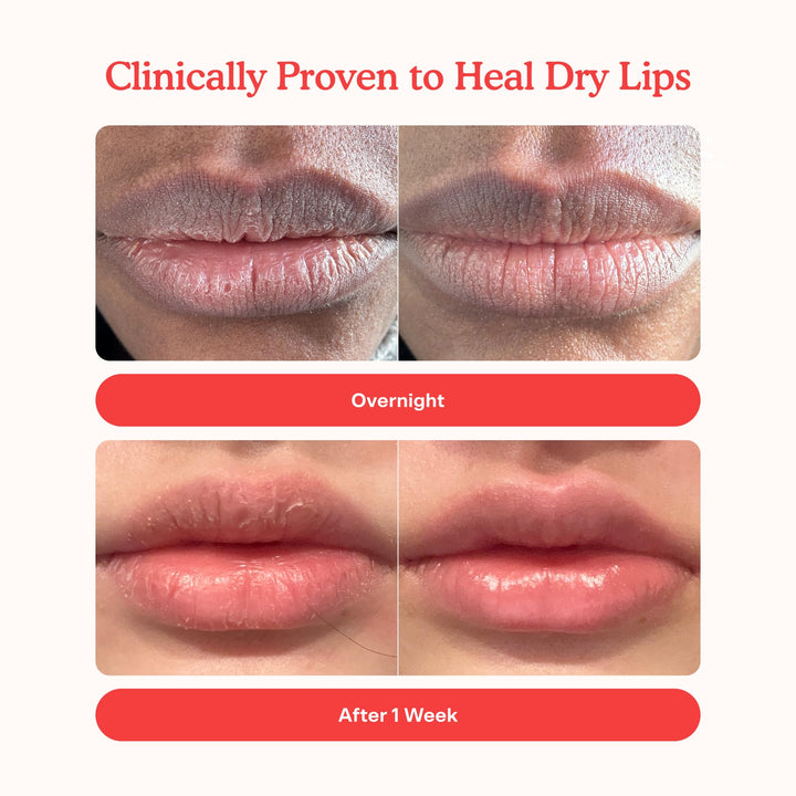 Lip Softie Hydrating Tinted Lip Treatment Balm - GLAM MODA
