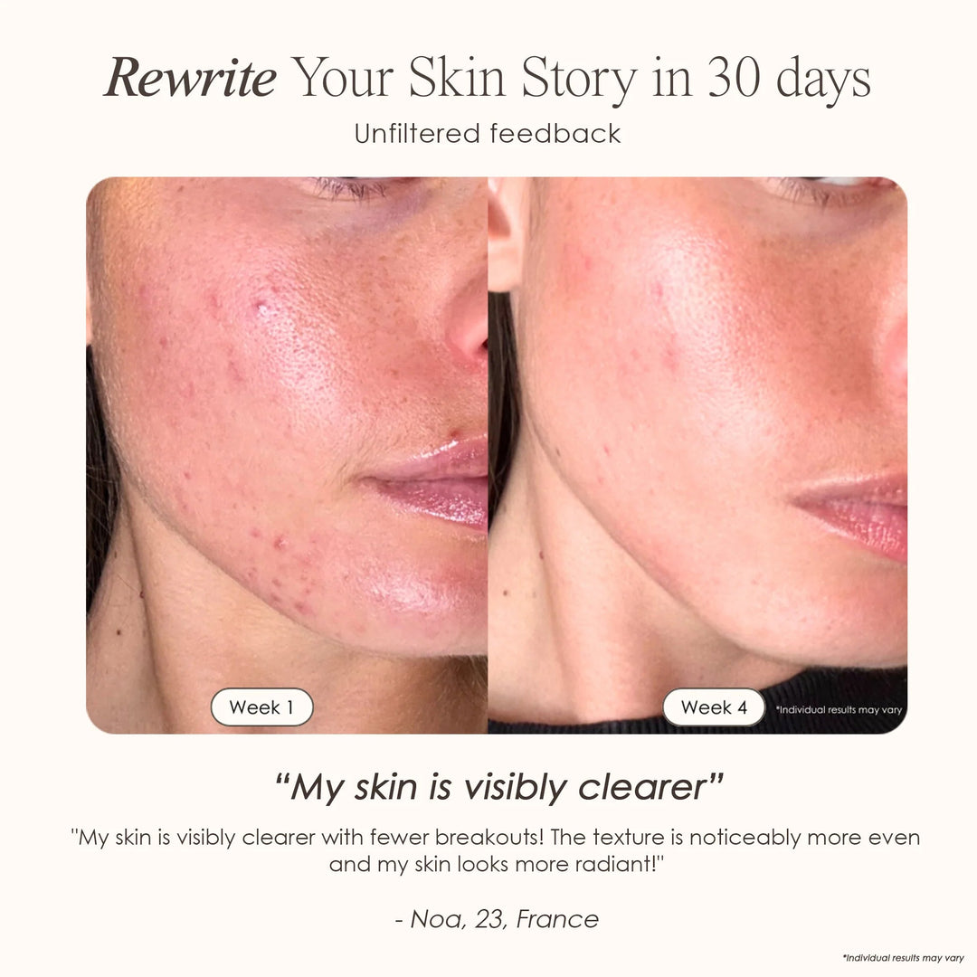 LumaLux Face | Pro LED Red Light Therapy Mask - GLAM MODA