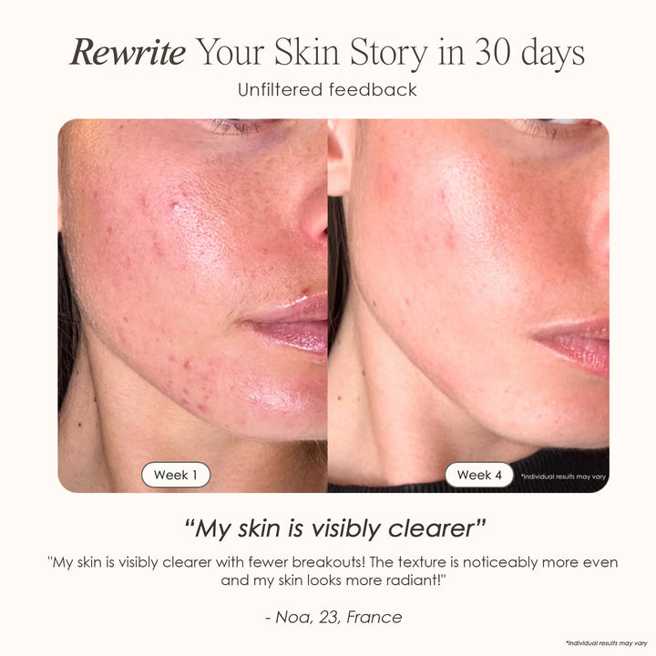 LumaLux Face | Pro LED Red Light Therapy Mask - GLAM MODA