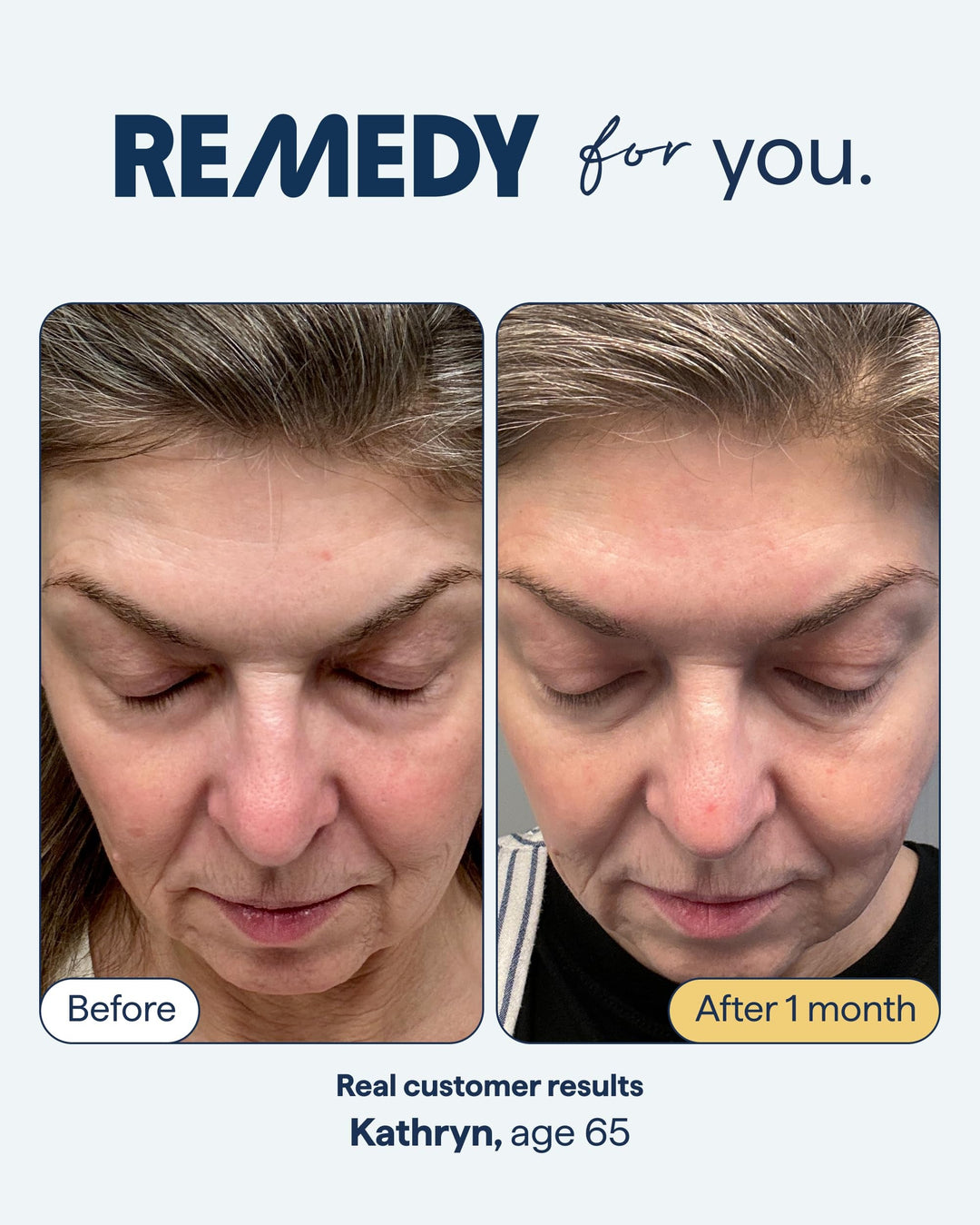 Healthy Aging Advanced Serum - GLAM MODA