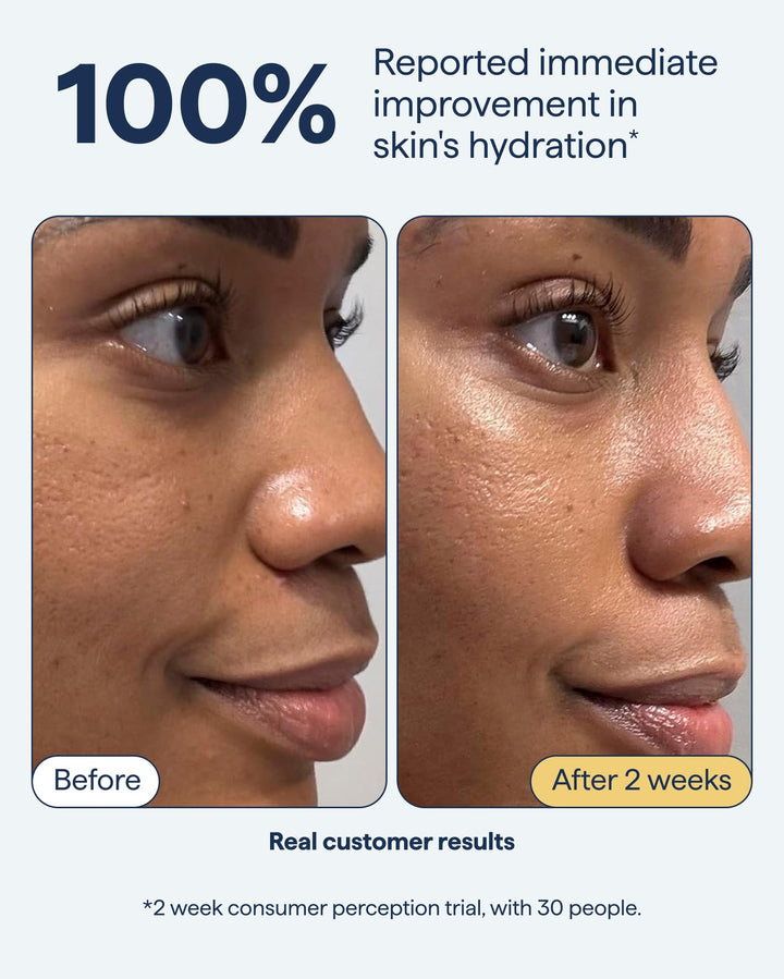 Rich Cream Barrier Repairing Moisturizer - GLAM MODA