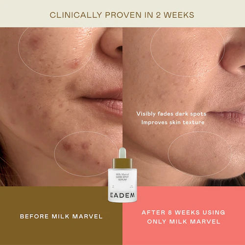 Milk Marvel Dark Spot Serum with Niacinamide and Vitamin C - GLAM MODA
