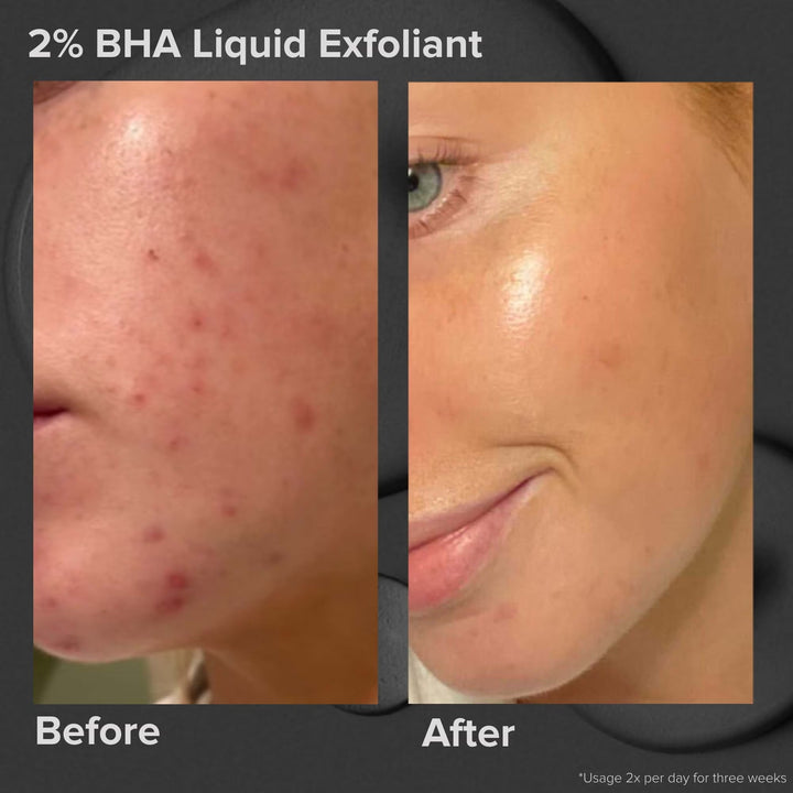 Multi-Level Exfoliation Set - GLAM MODA