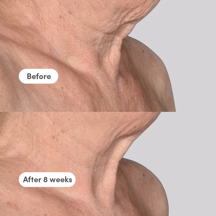 Neck/Décolleté Concentrate - The Elevator - GLAM MODA