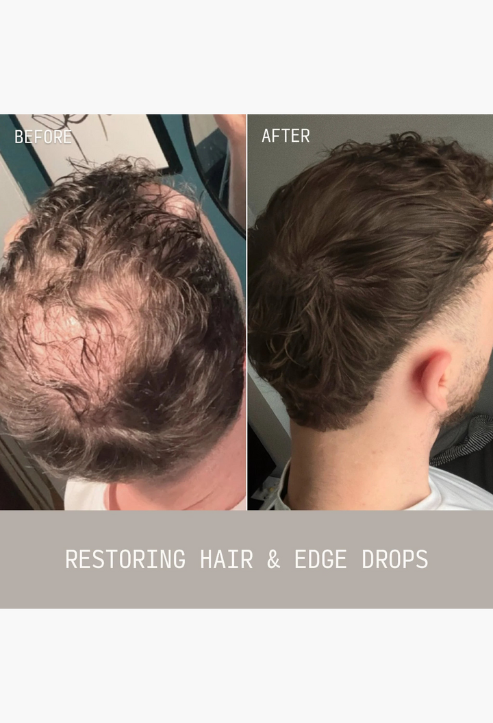 GLAM MODA before and after results showing hair density improvement on a man's scalp using Restoring Hair & Edge Drops