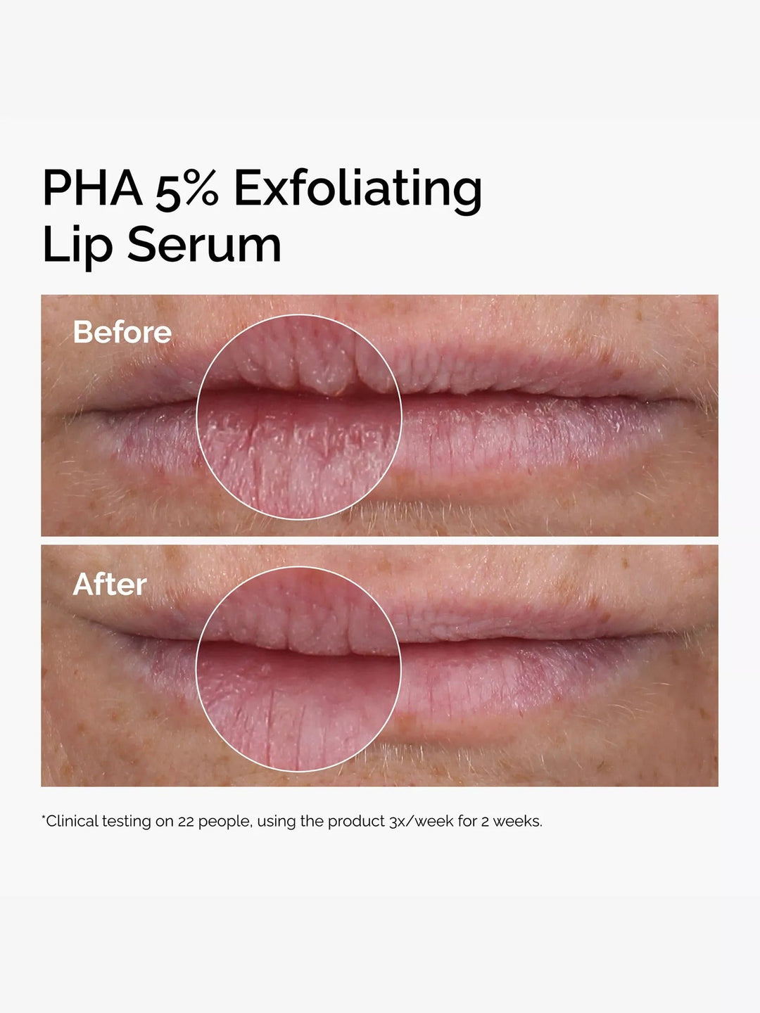 PHA 5% Exfoliating Lip Serum - GLAM MODA