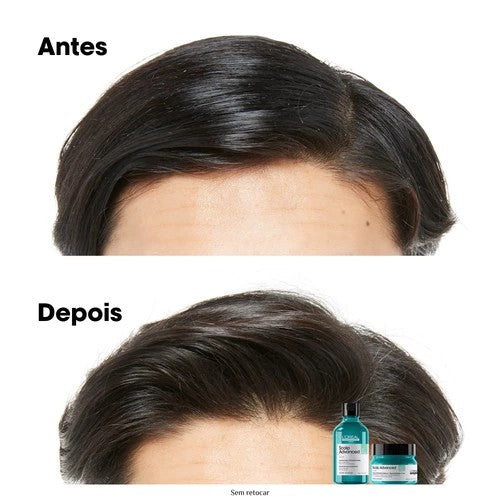 Pro Serie Expert Scalp Advance Clay 2 In 1 For Oily Hair - GLAM MODA