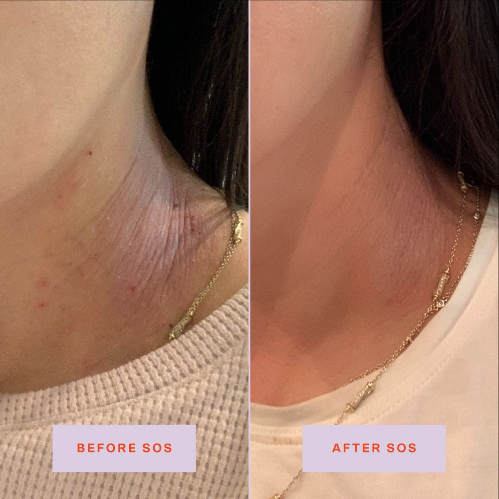 SOS Rescue Spray - GLAM MODA