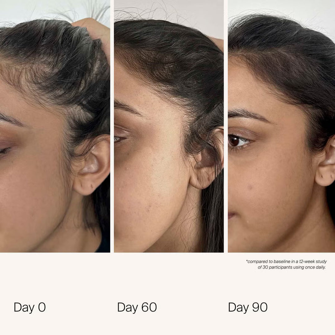 Scalp Care Density Serum - 50ml - GLAM MODA