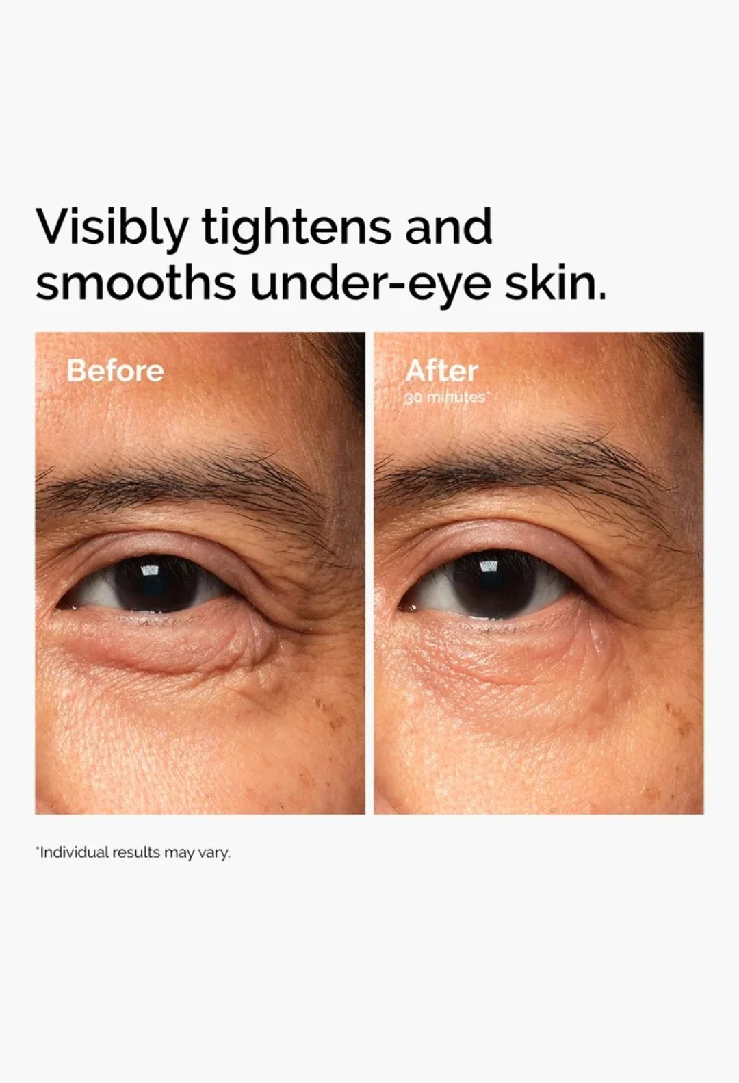 Lacto-PDRN* 4% + B9 Eye Cream