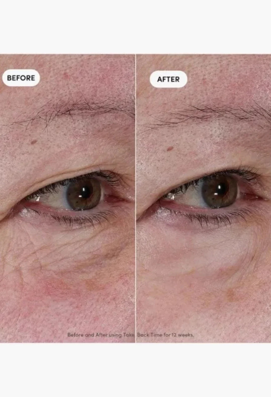 Take Back Time Miniprotein™ Eye Treatment