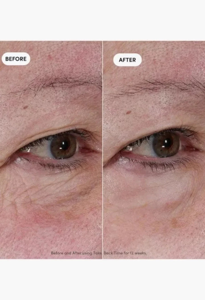 Take Back Time Miniprotein™ Eye Treatment