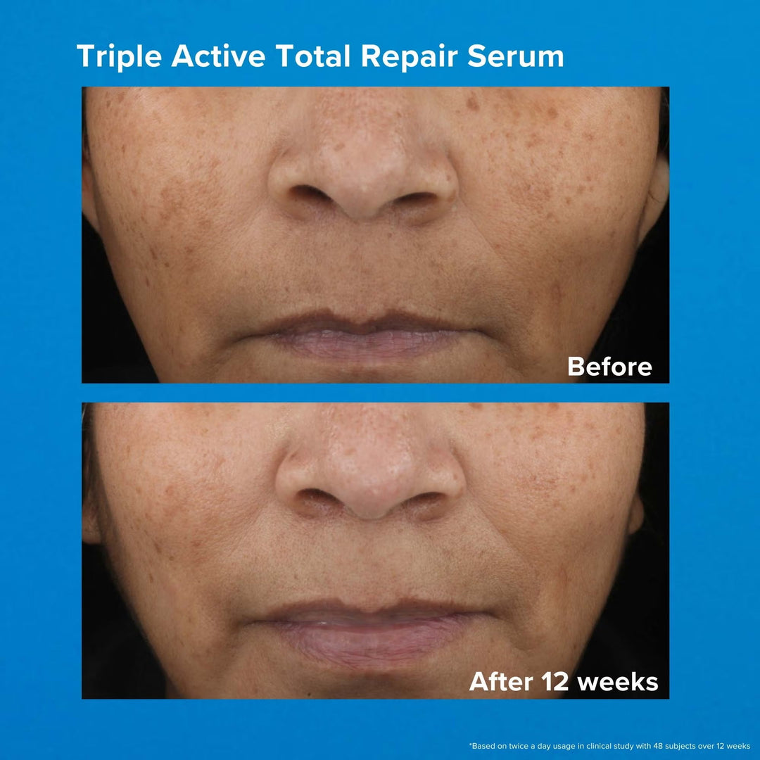 Triple Active Total Repair Serum 30ml - GLAM MODA