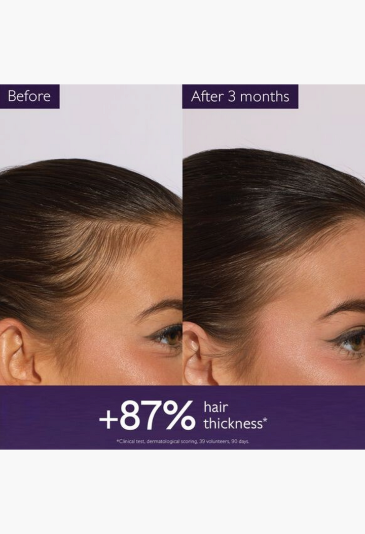 GLAM MODA before and after comparison showing increased hair thickness and volume after using anti-hair loss serum.