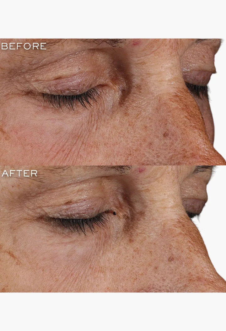 Génifique Ultimate Eye Cream,