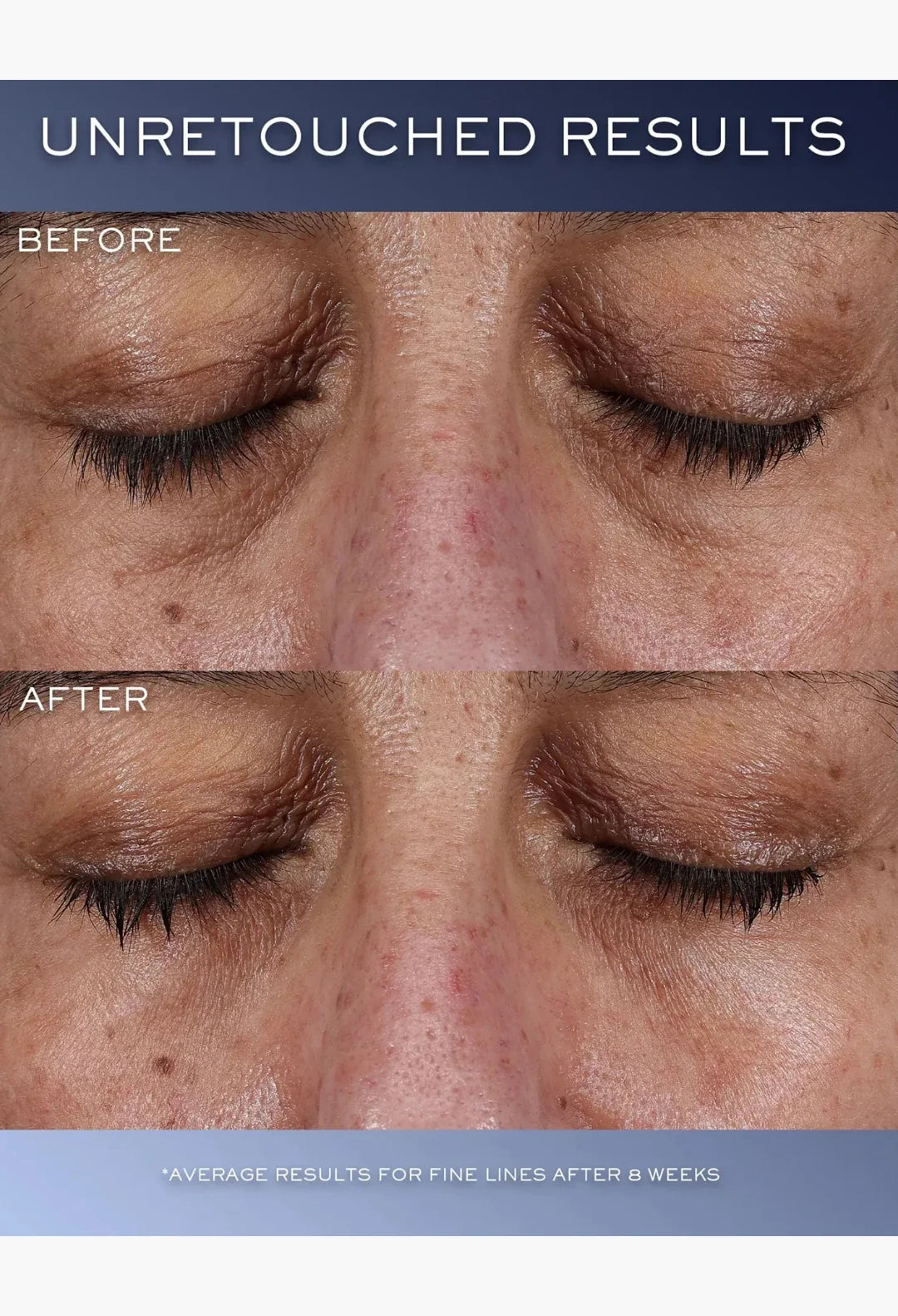 Génifique Ultimate Eye Cream,