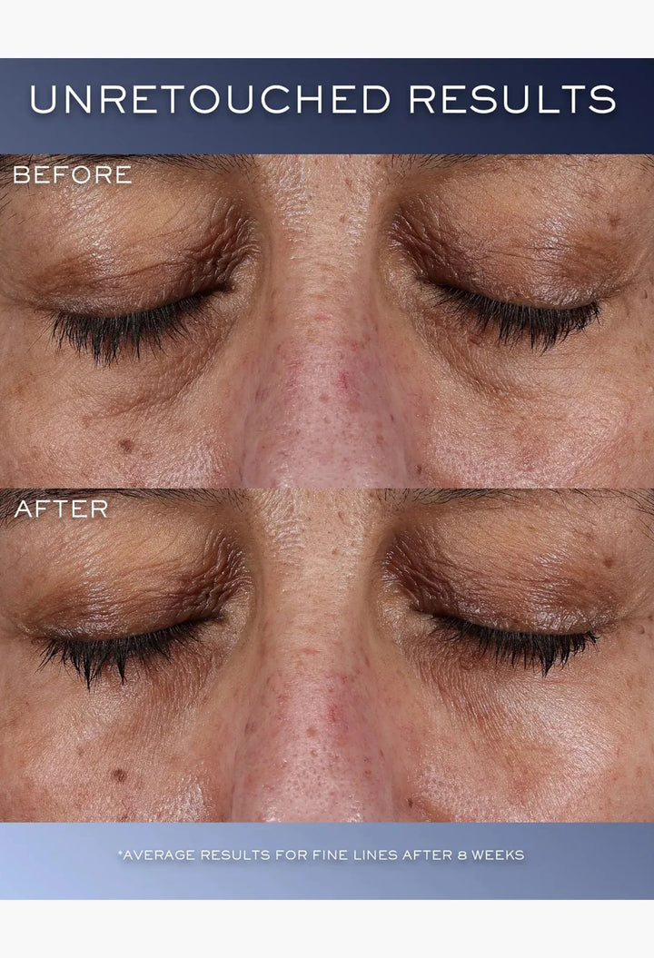 Génifique Ultimate Eye Cream,